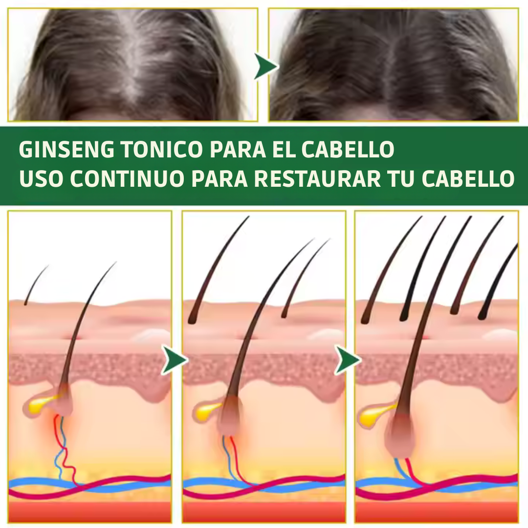 Tónico Capilar OUHOE Para la Caída del Cabello